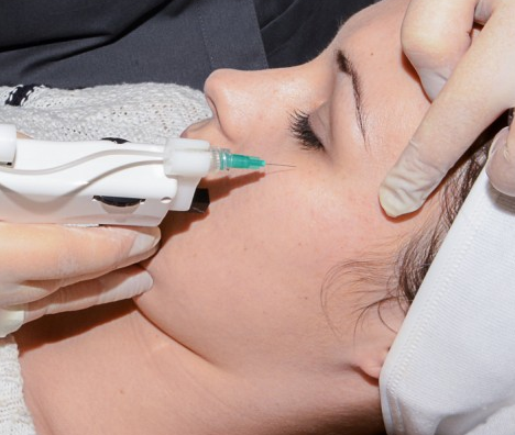 Injection botox et fils tenseurs | Eureka Centre Médical Esthétique à Liège - photo 10